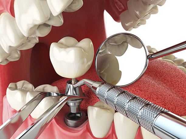 Best Emergency Dental Care for Broken or Chipped Teeth in Salix, PA